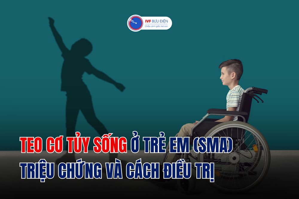 Teo cơ tủy sống ở trẻ em (SMA): Triệu chứng và cách điều trị