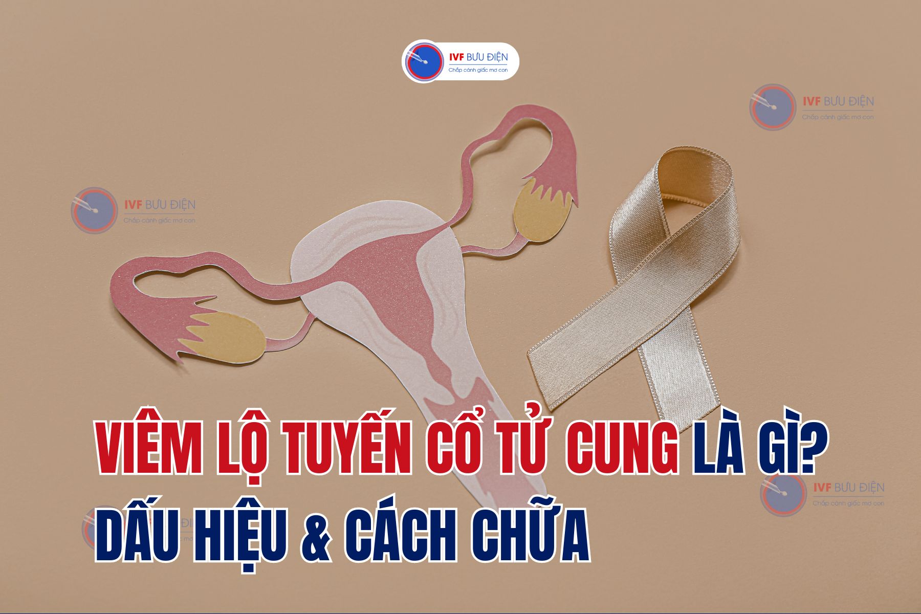 Viêm lộ tuyến cổ tử cung là gì? Dấu hiệu & cách chữa