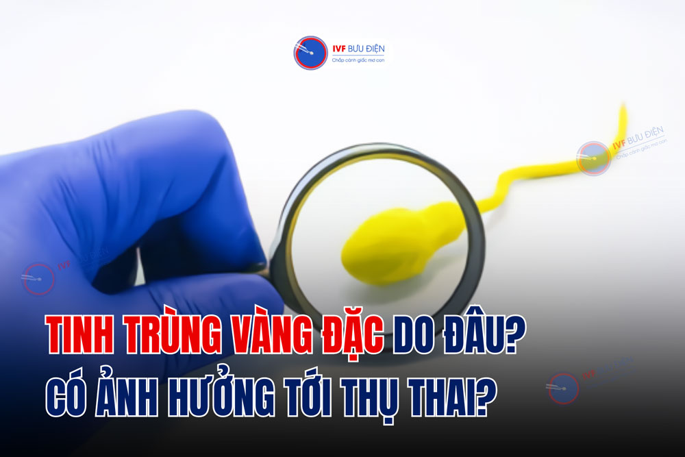 Tinh trùng vàng đặc do đâu? Có ảnh hưởng tới thụ thai?