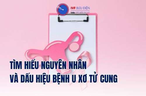 U xơ tử cung là gì? Nguyên nhân, dấu hiệu nhận biết