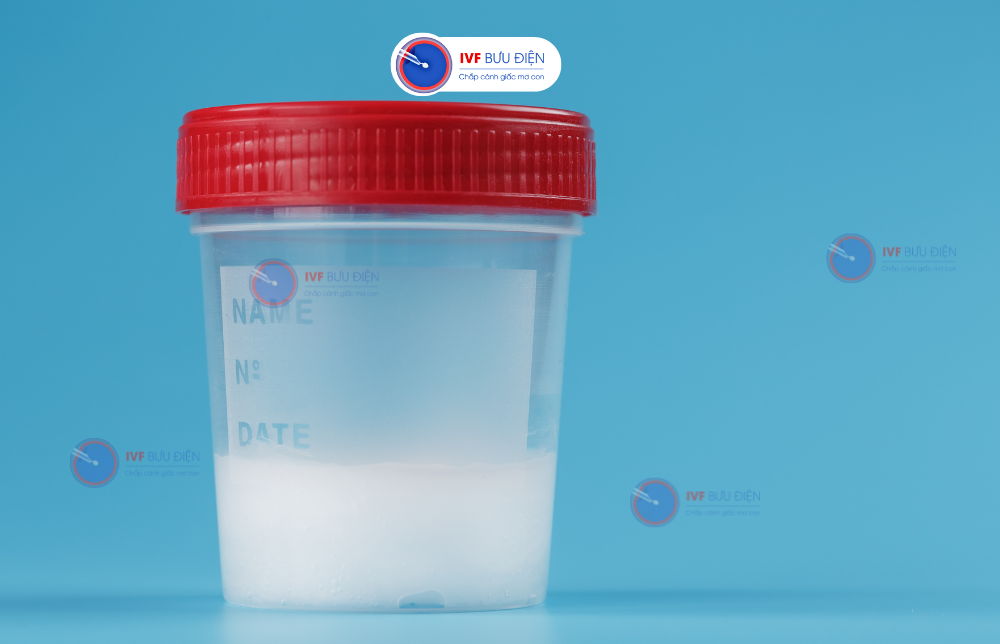 Vi mất đoạn AZF