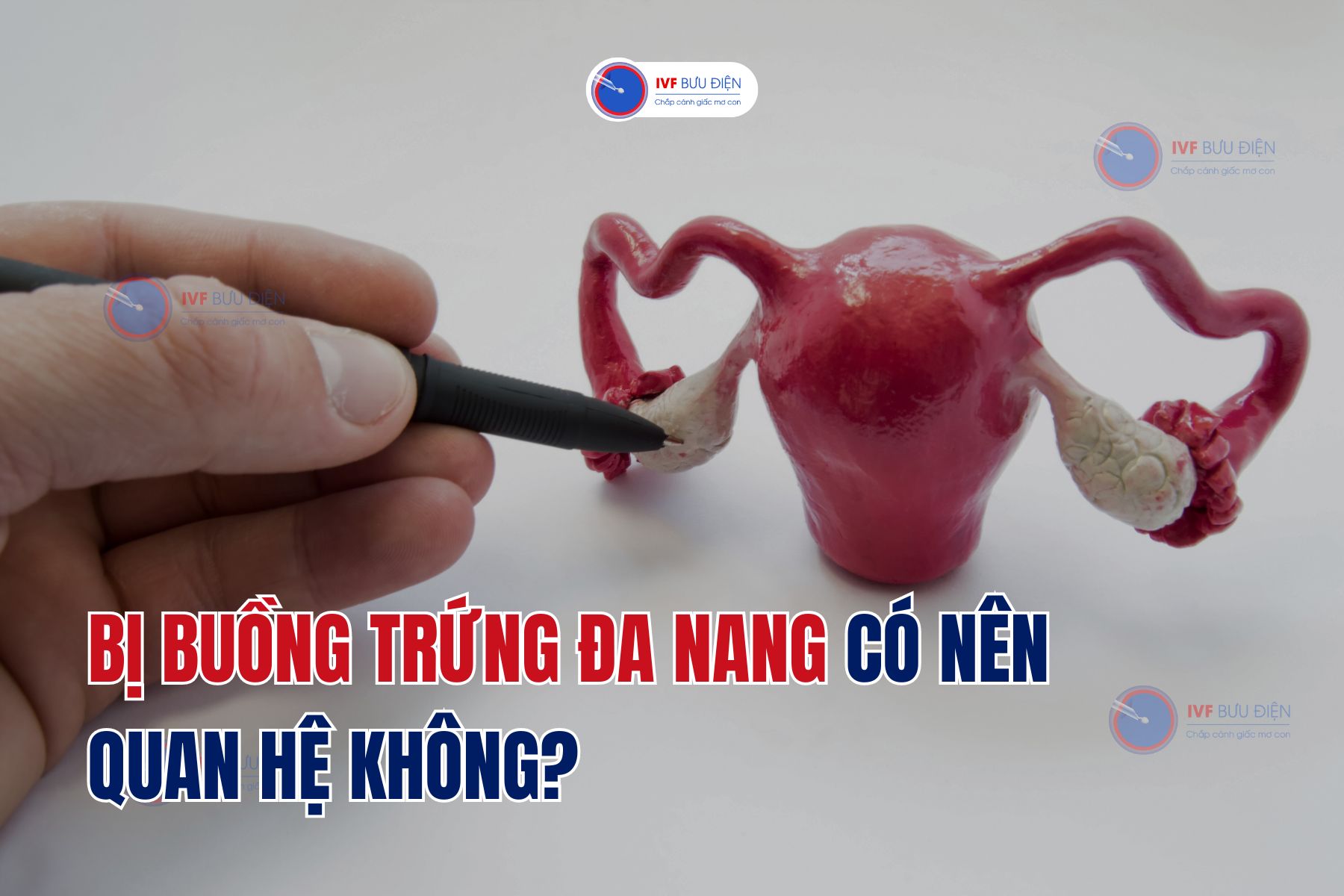 Bị buồng trứng đa nang có nên quan hệ không?