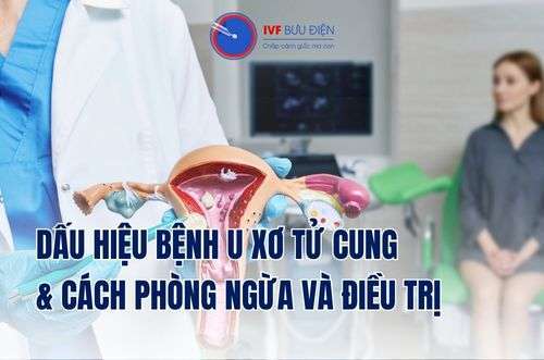 Dấu hiệu u xơ tử cung: Tìm hiểu để phòng ngừa và điều trị