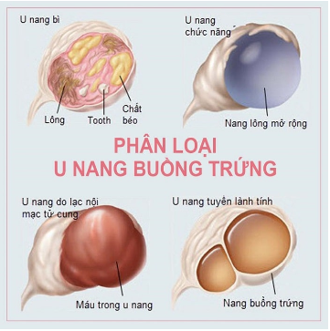 u nang thực thể