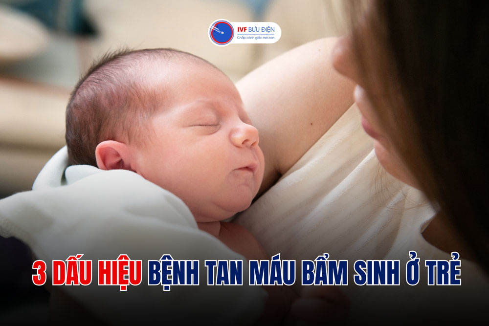 3 dấu hiệu bệnh tan máu bẩm sinh ở trẻ