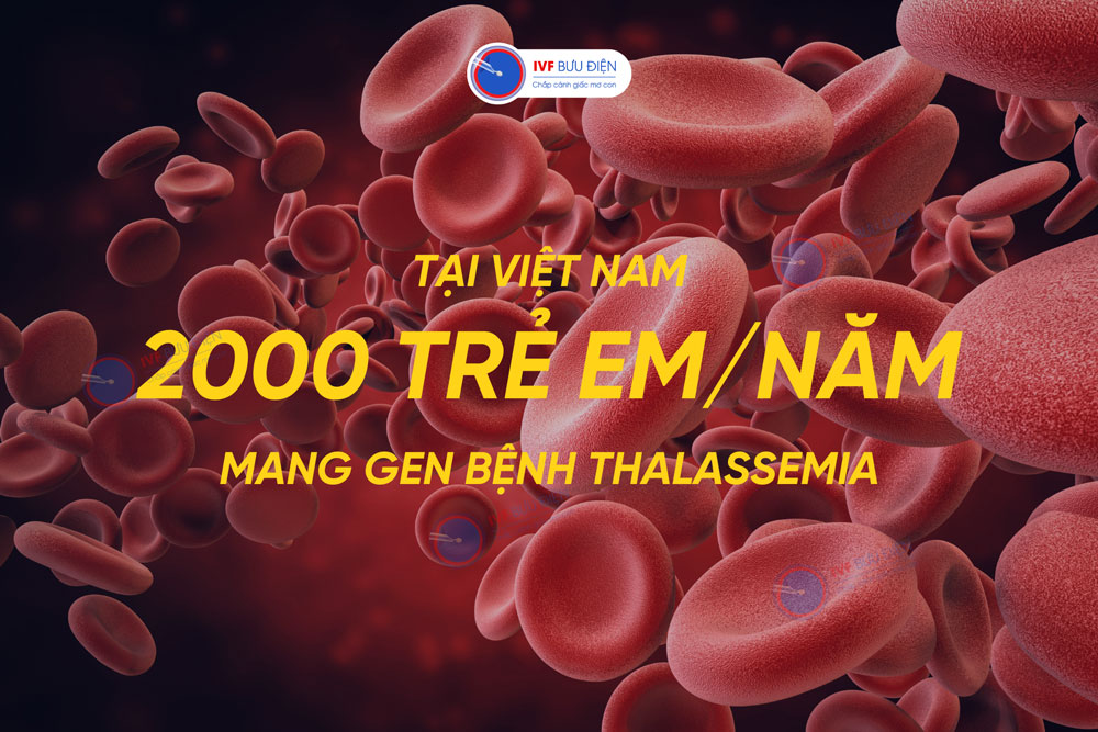 Mỗi năm tại Việt Nam có khoảng 2000 trẻ em sinh ra mang gen bệnh 