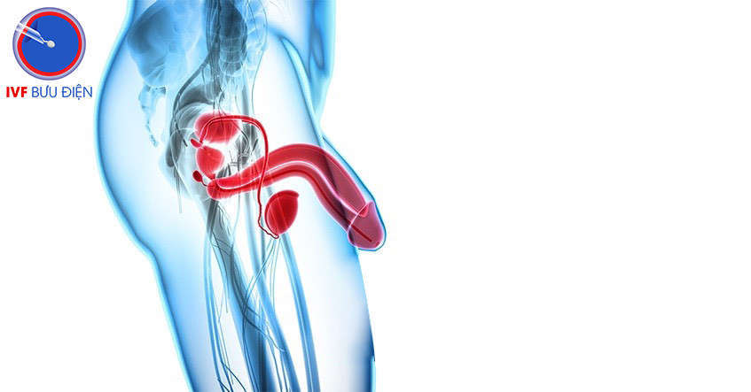 Tinh hoàn không nằm trong bìu mà nằm trong bụng, lỗ bẹn sâu, ống bẹn và lỗ bẹn nông