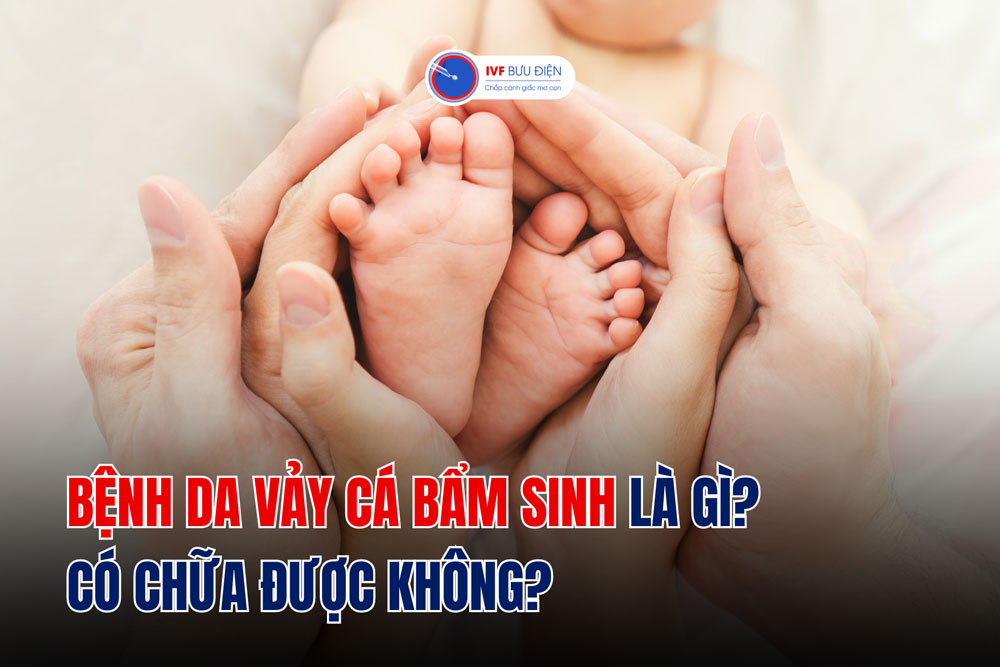 Bệnh da vảy cá bẩm sinh là gì? Có chữa được không?