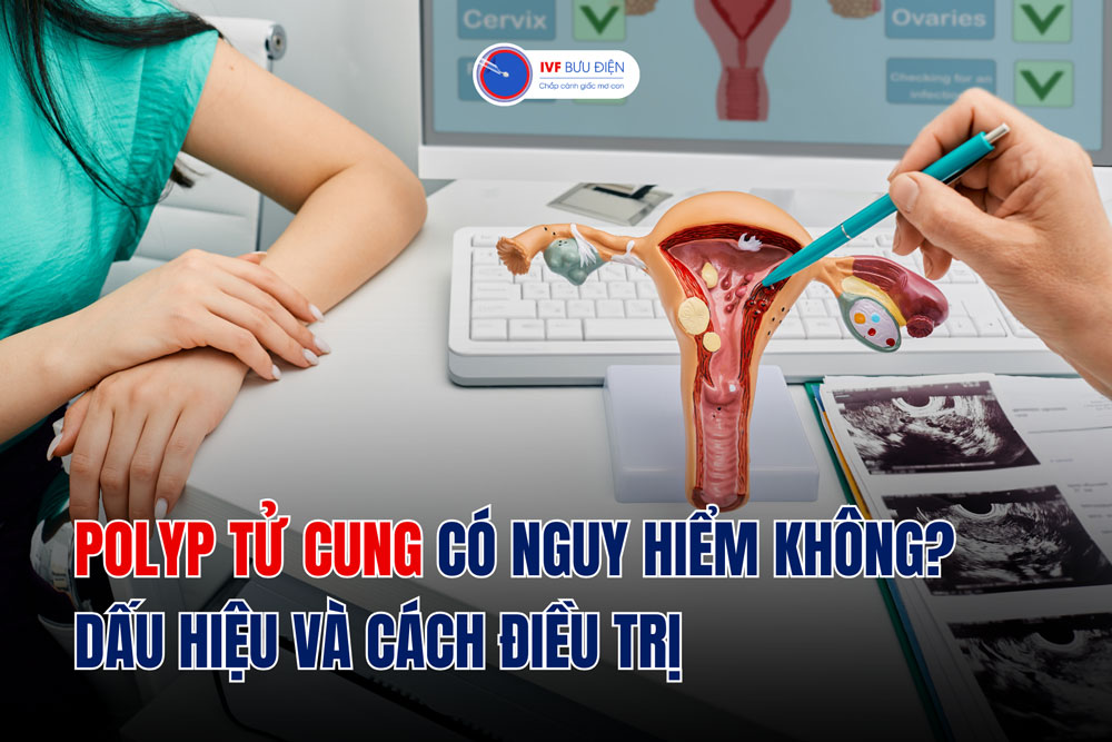 Polyp tử cung có nguy hiểm không? Dấu hiệu và cách điều trị