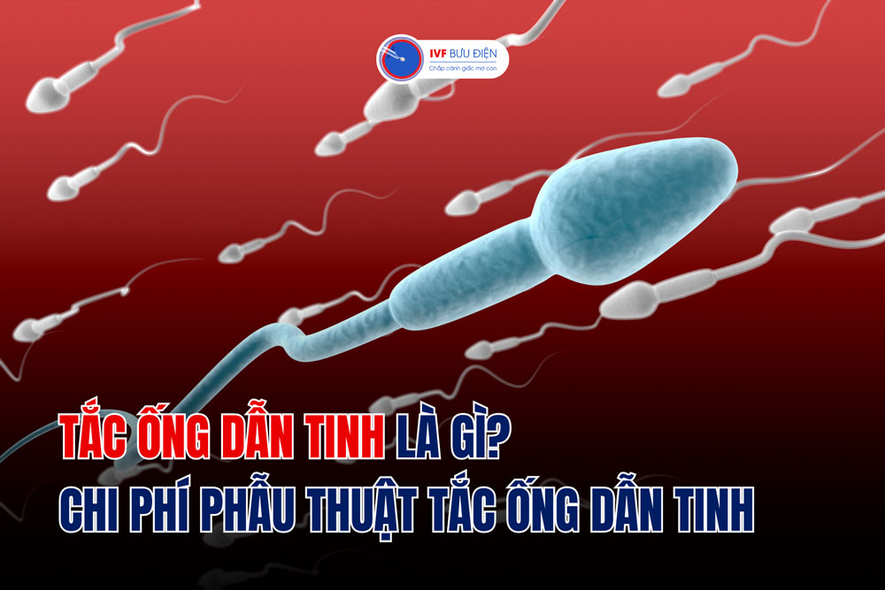 Tắc ống dẫn tinh là gì? Chi phí phẫu thuật tắc ống dẫn tinh