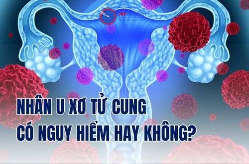 Nhân u xơ tử cung có nguy hiểm không? IVF Bưu Điện