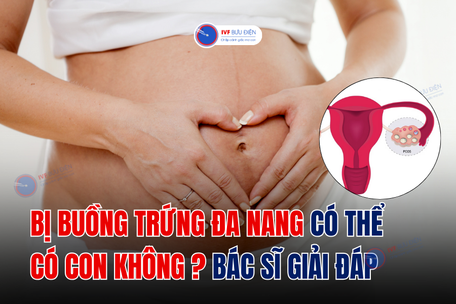 Bị buồng trứng đa nang có thể có con không? Bác sĩ giải đáp