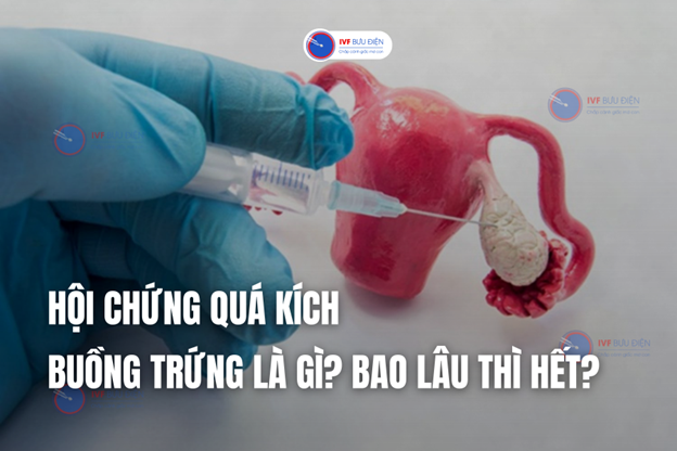 Hội chứng quá kích buồng trứng là gì? Bao lâu thì hết?