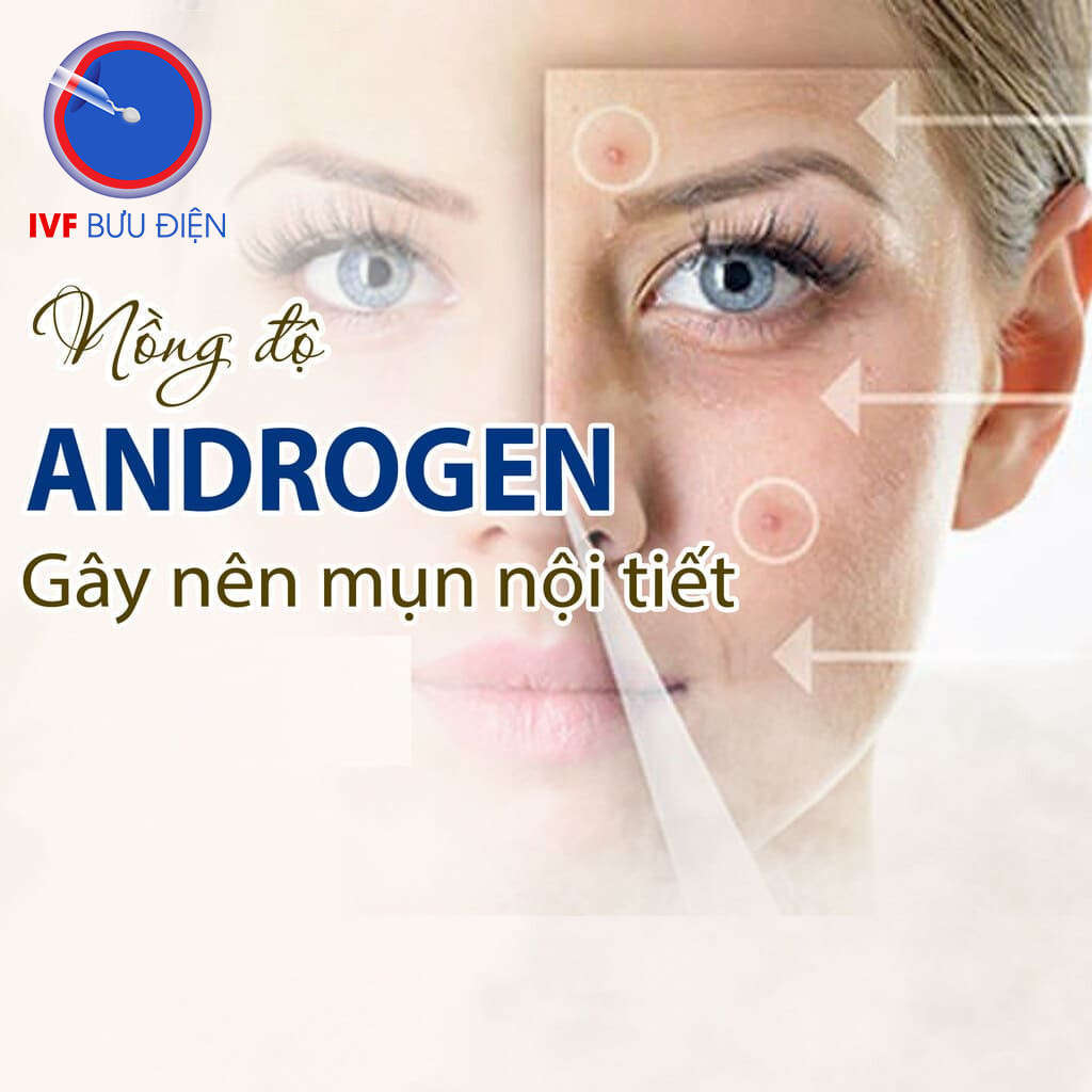 Nồng độ Androgen gây nên mụn nội tiết