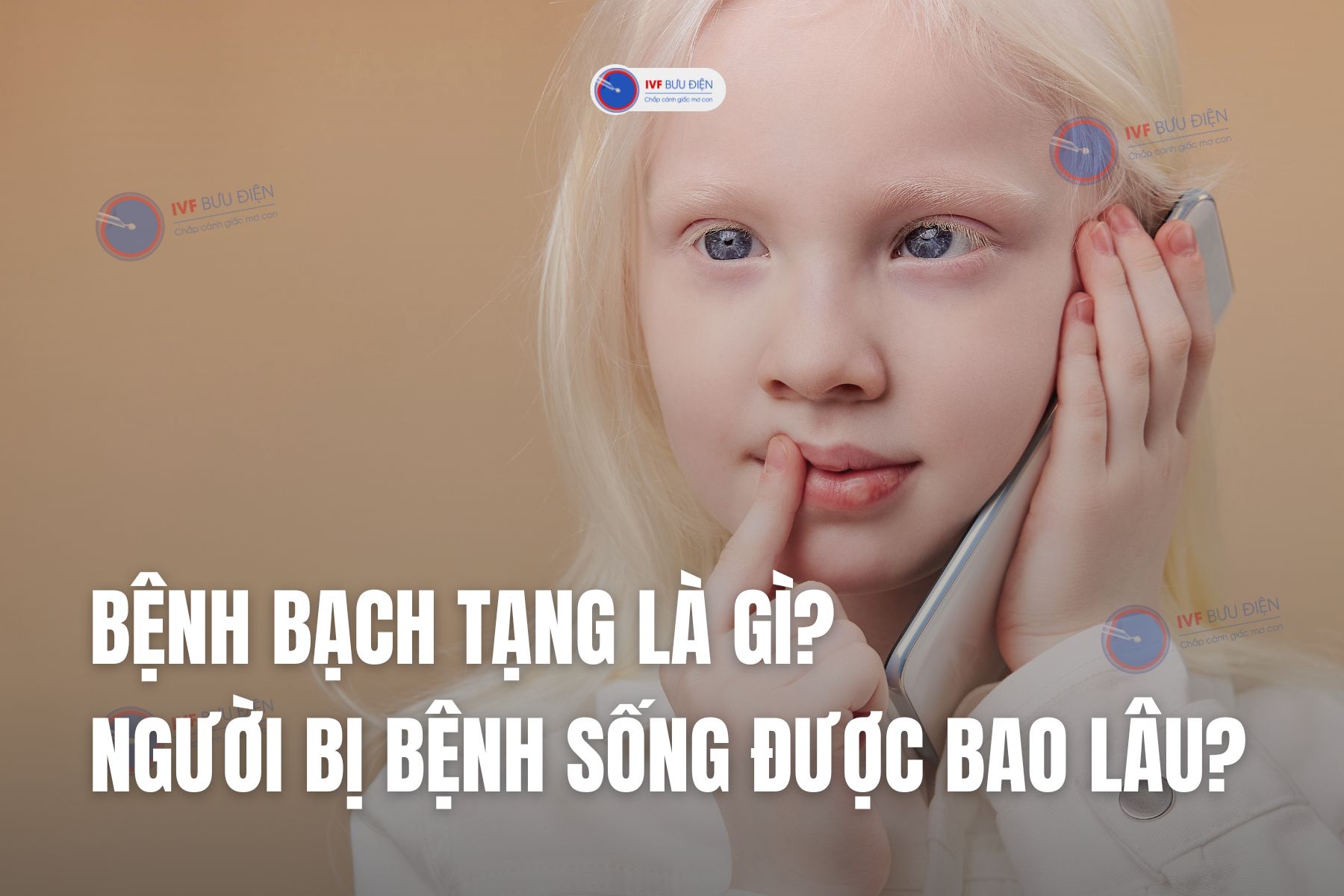 Bệnh bạch tạng là gì? Người bị bệnh sống được bao lâu?