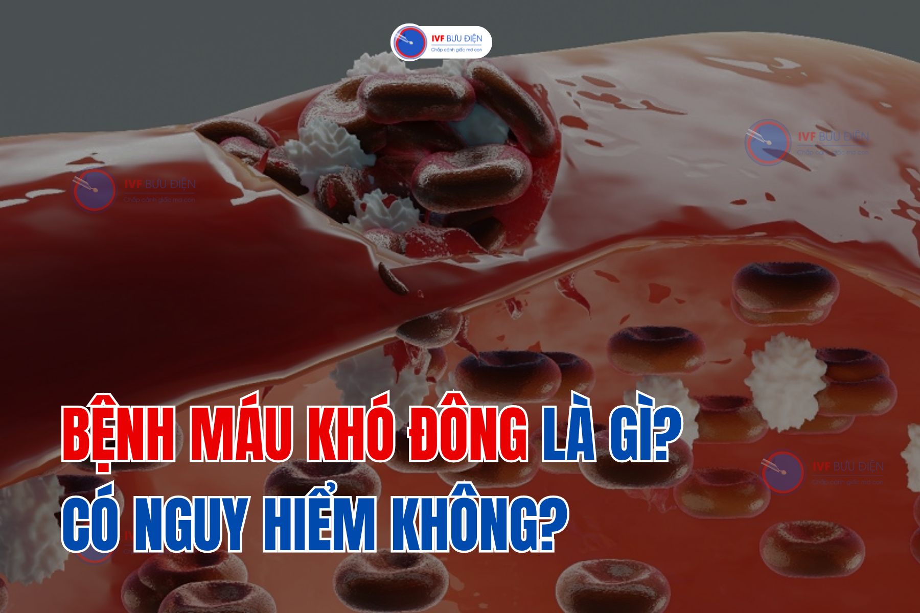 Bệnh máu khó đông là gì? Có nguy hiểm không?