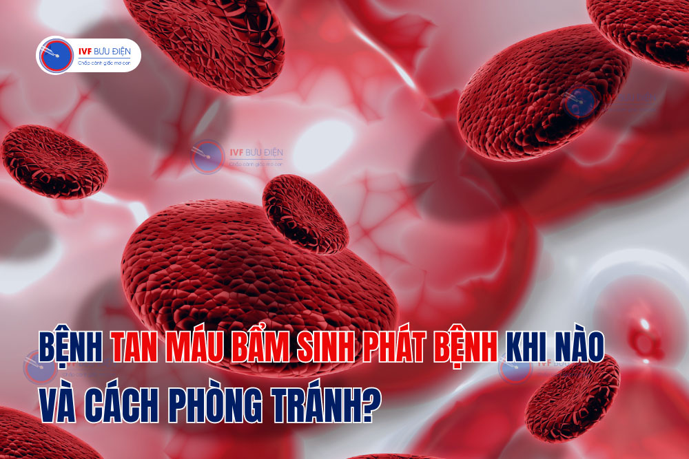 Bệnh tan máu bẩm sinh phát bệnh khi nào và cách phòng tránh?