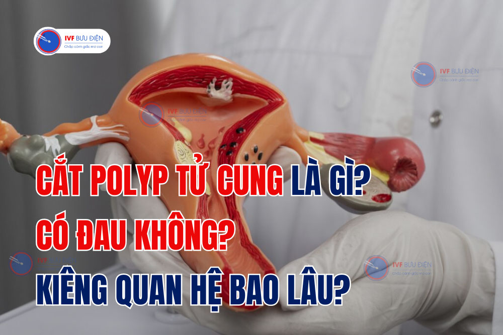 Cắt polyp tử cung là gì? Có đau không? Kiêng quan hệ bao lâu?