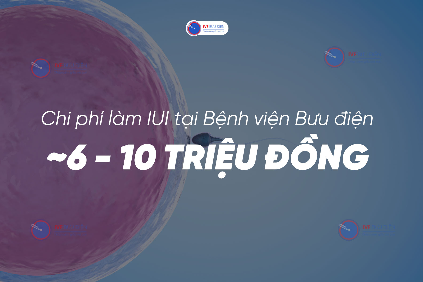 Chi phí làm IUI tại Bệnh viện Bưu điện dao động từ 6 - 10 triệu đồng