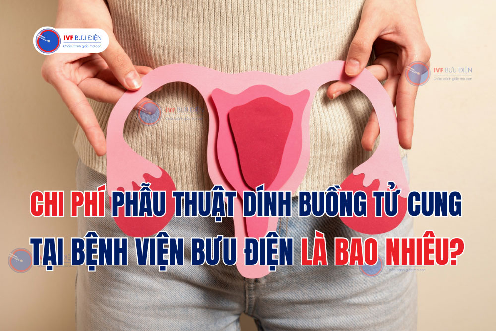 Chi Phí Phẫu Thuật Dính Buồng Tử Cung tại Bệnh Viện Bưu Điện là bao nhiêu?