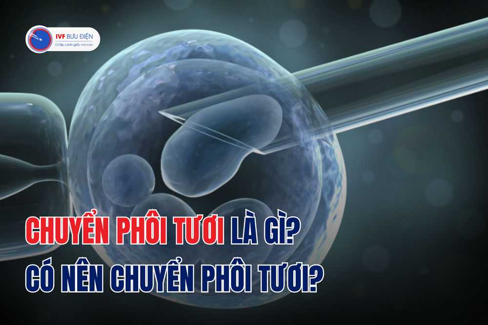 Chuyển phôi tươi là gì? Có nên chuyển phôi tươi?