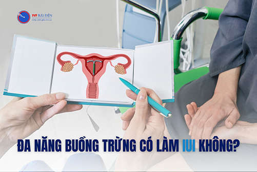 Buồng trứng đa nang có làm iui được không?