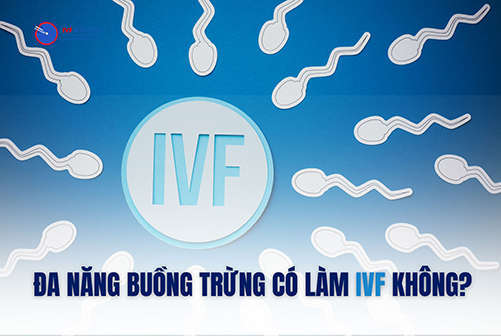 Buồng trứng đa nang có làm ivf được không?