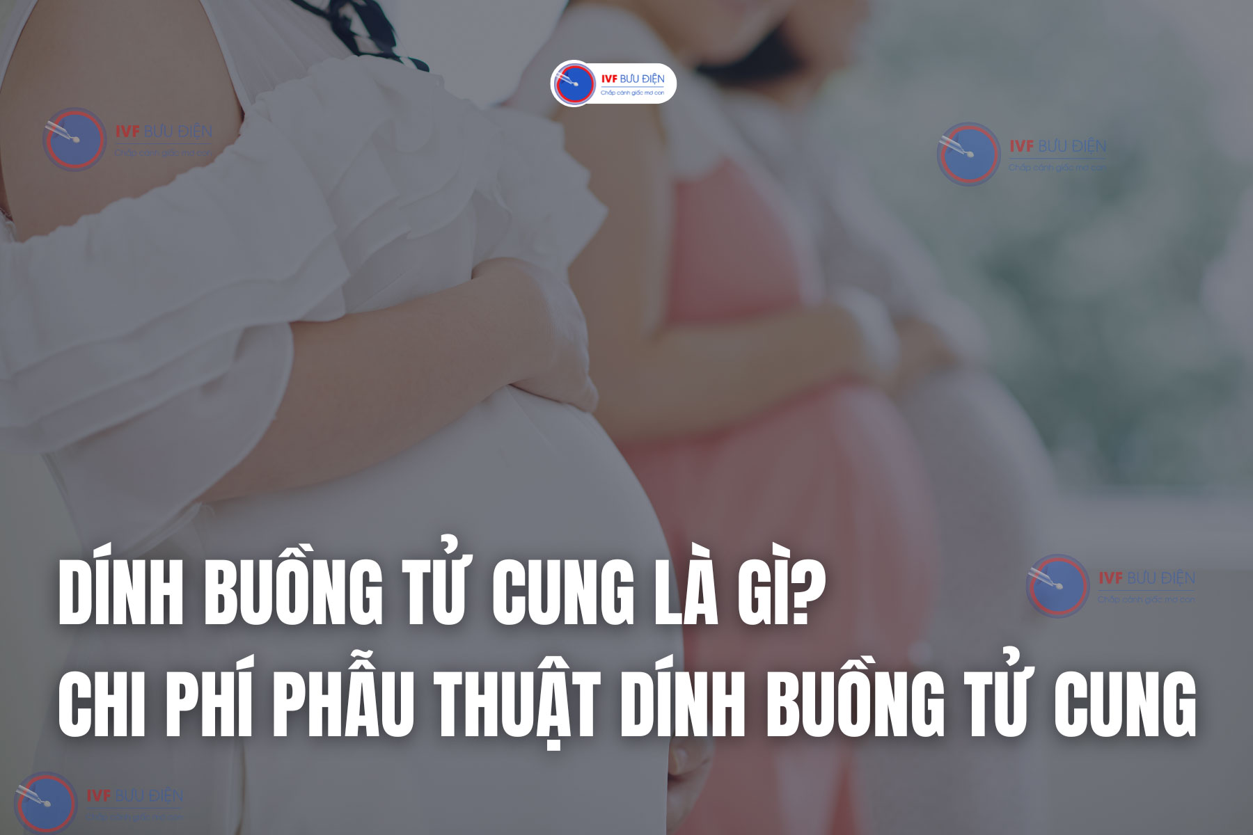 Dính buồng tử cung là gì? Chi phí phẫu thuật dính buồng tử cung