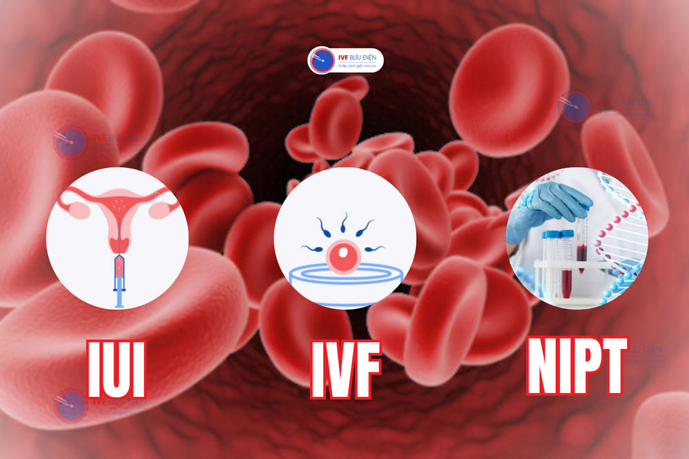 3 phương pháp vợ chồng mang gen Thalassemia cần biết khi có ý định mang thai