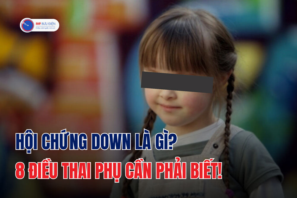 Hội chứng Down là gì? 8 điều thai phụ cần phải biết