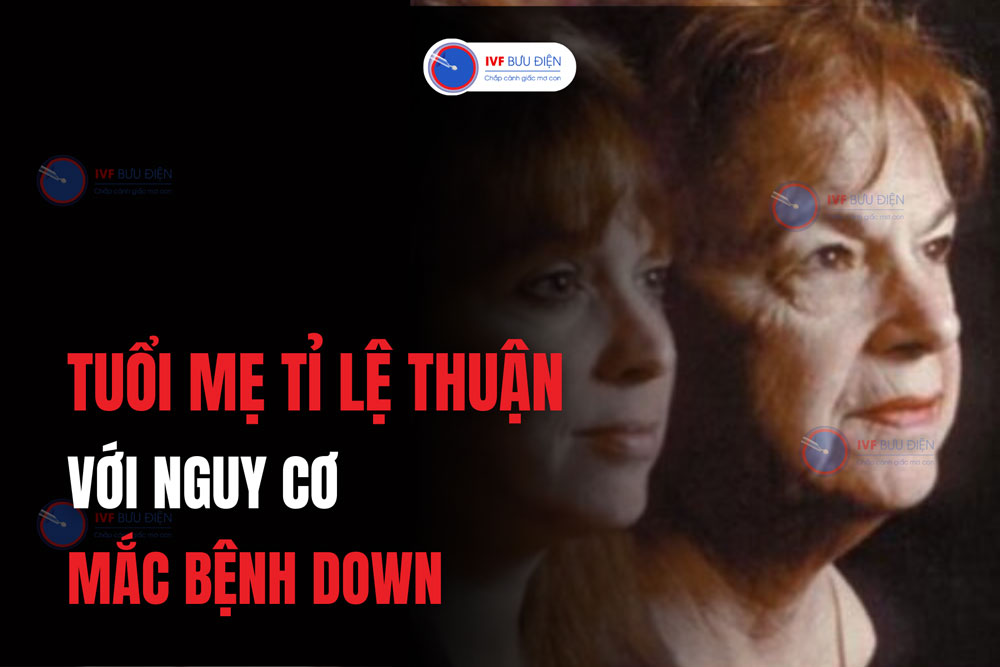 Hội chứng Down theo tuổi mẹ