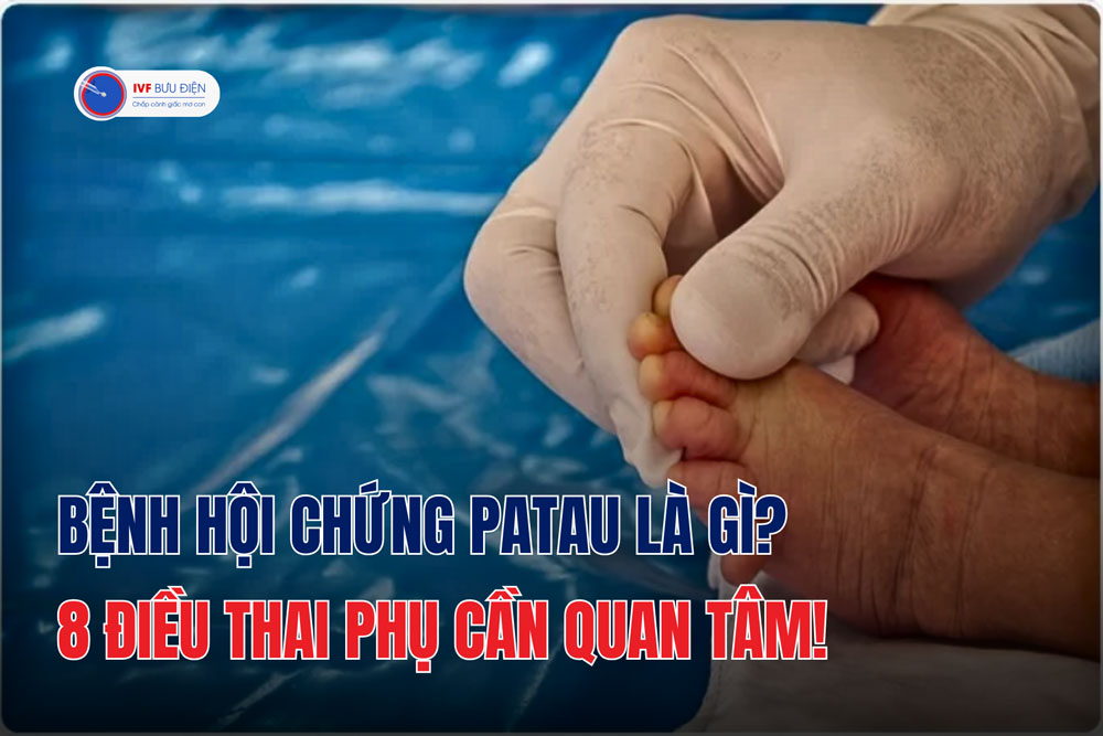 Bệnh hội chứng patau là gì? 8 điều thai phụ cần quan tâm!