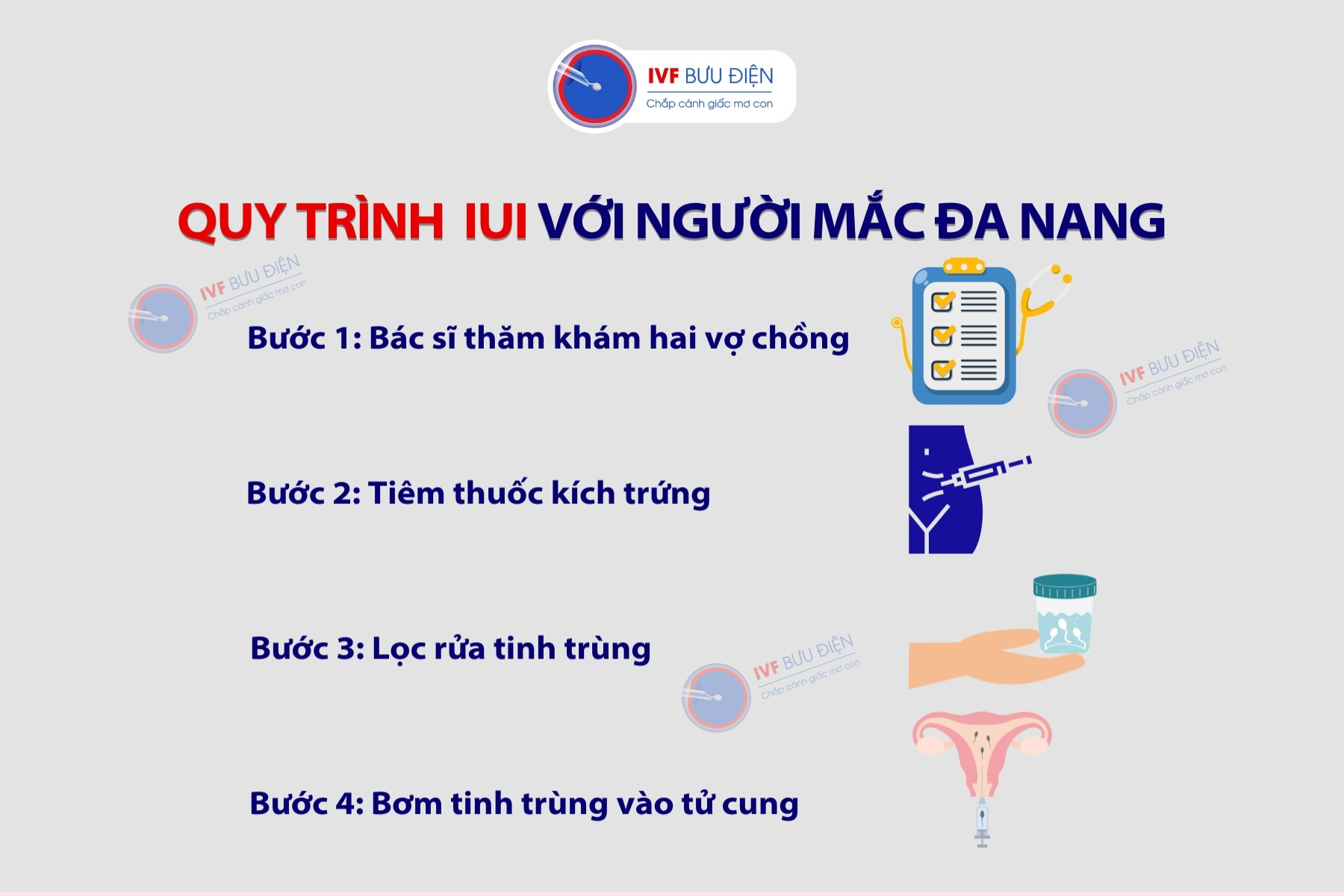 Đa nang có làm IUI được không: Quy trình làm IUI