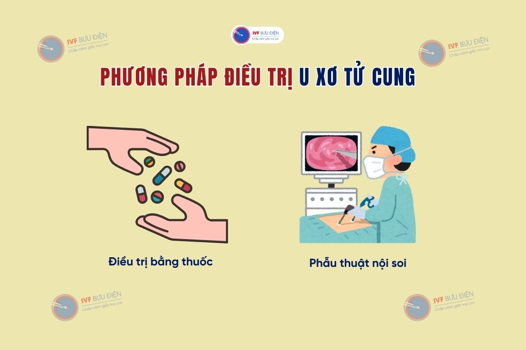 Các phương pháp điều trị U xơ tử cung