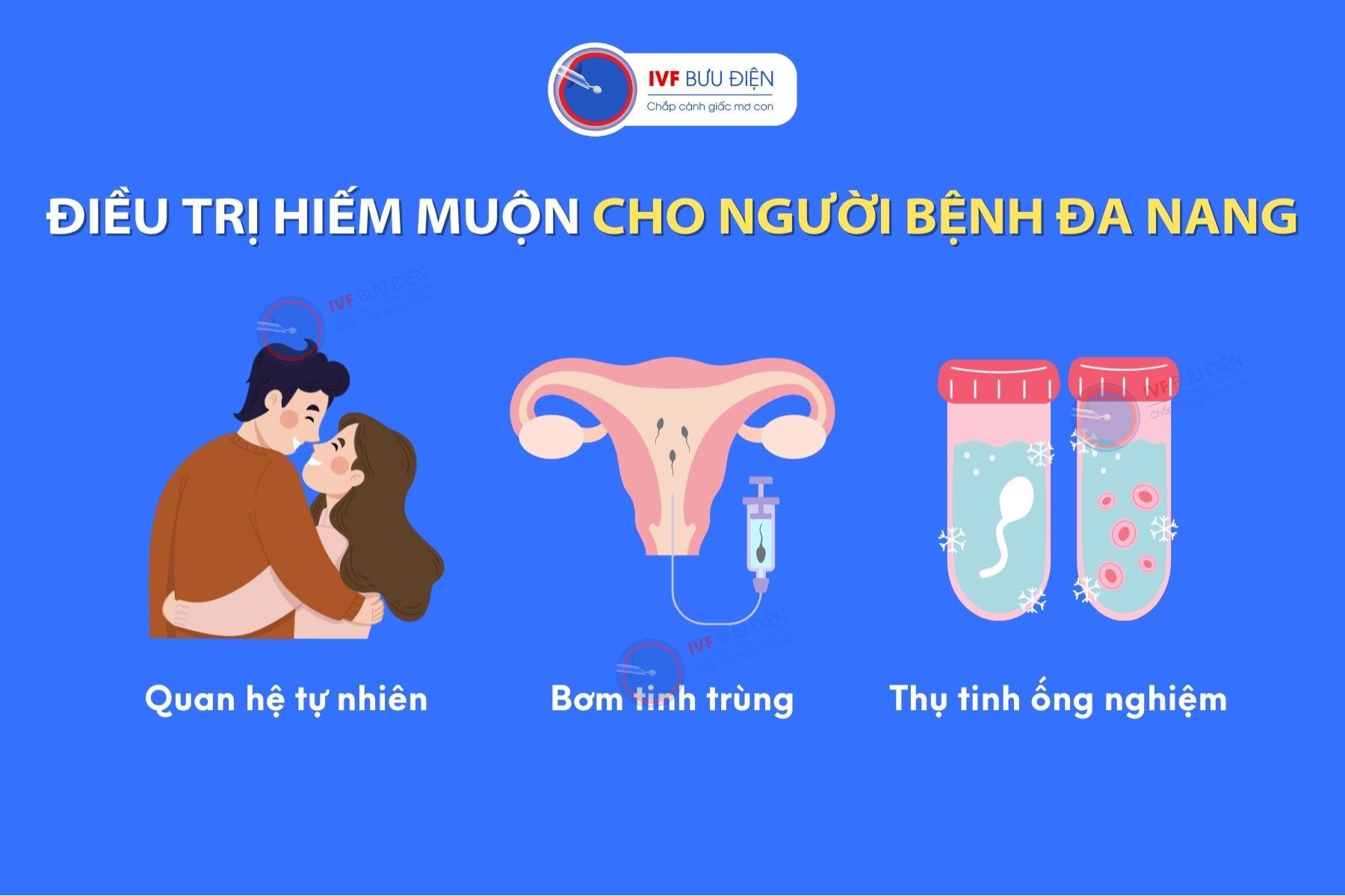 Điều trị hiếm muộn cho người bị bệnh đa nang