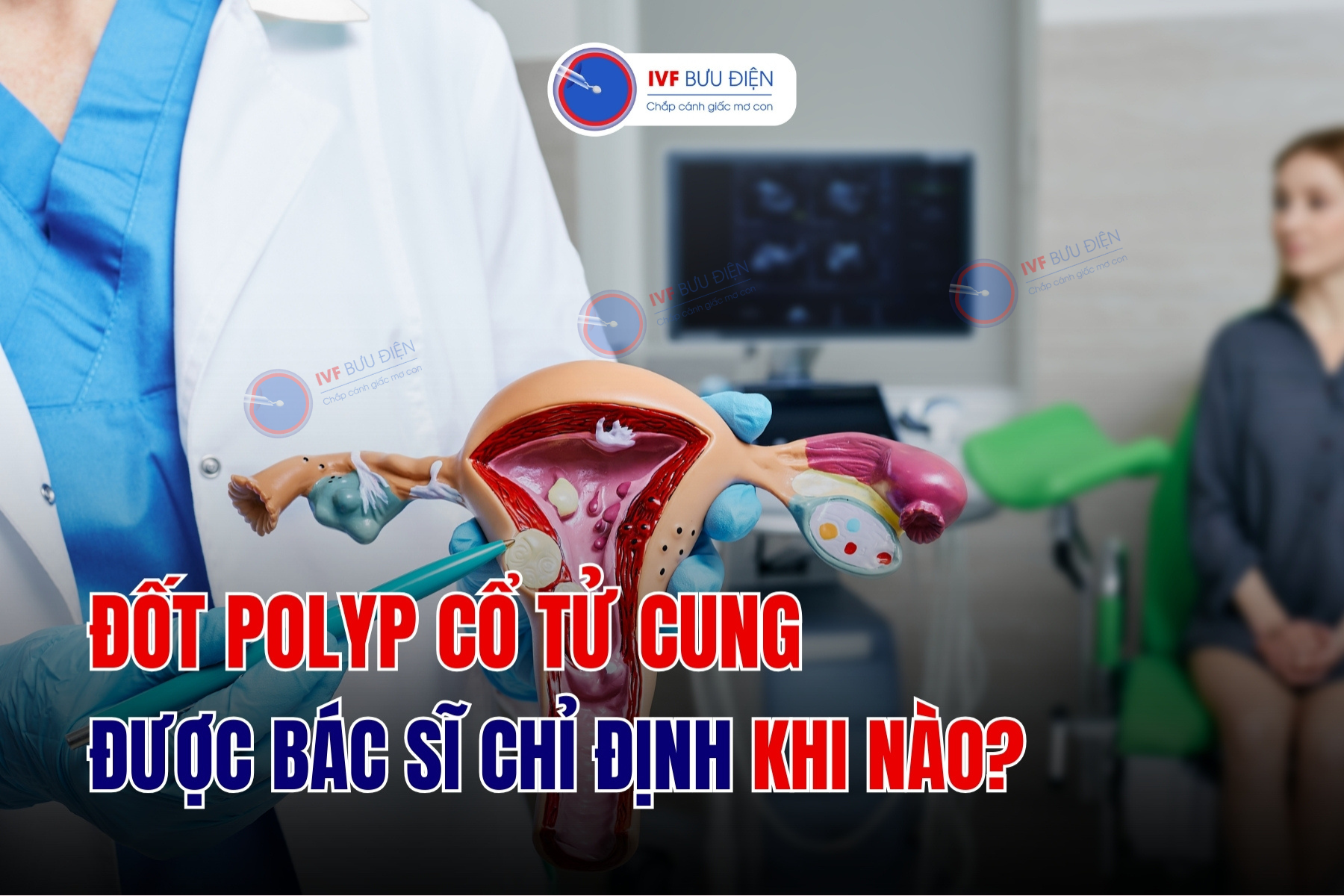 Đốt polyp cổ tử cung: 3 trường hợp được bác sĩ chỉ định