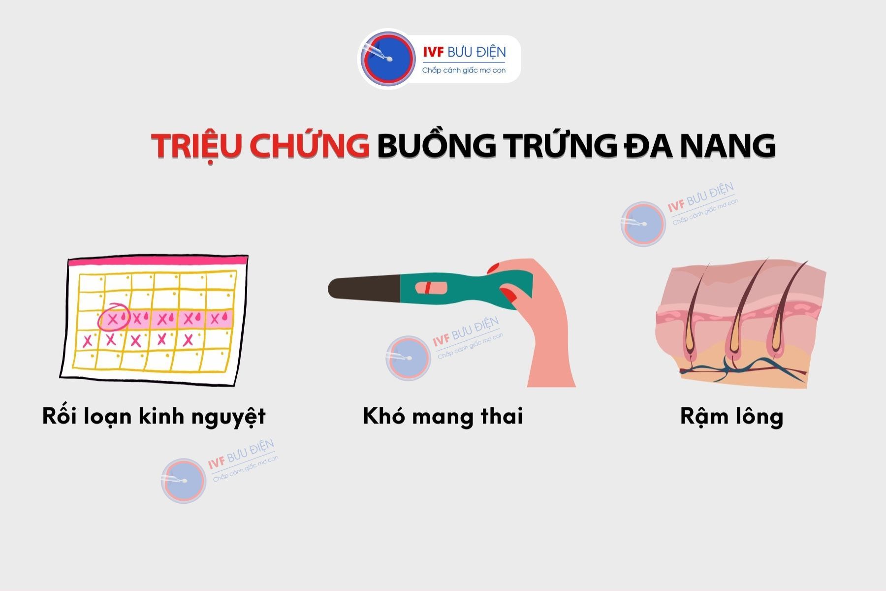 Buông trứng đa nang có rụng trứng không: Những triệu chứng của bệnh