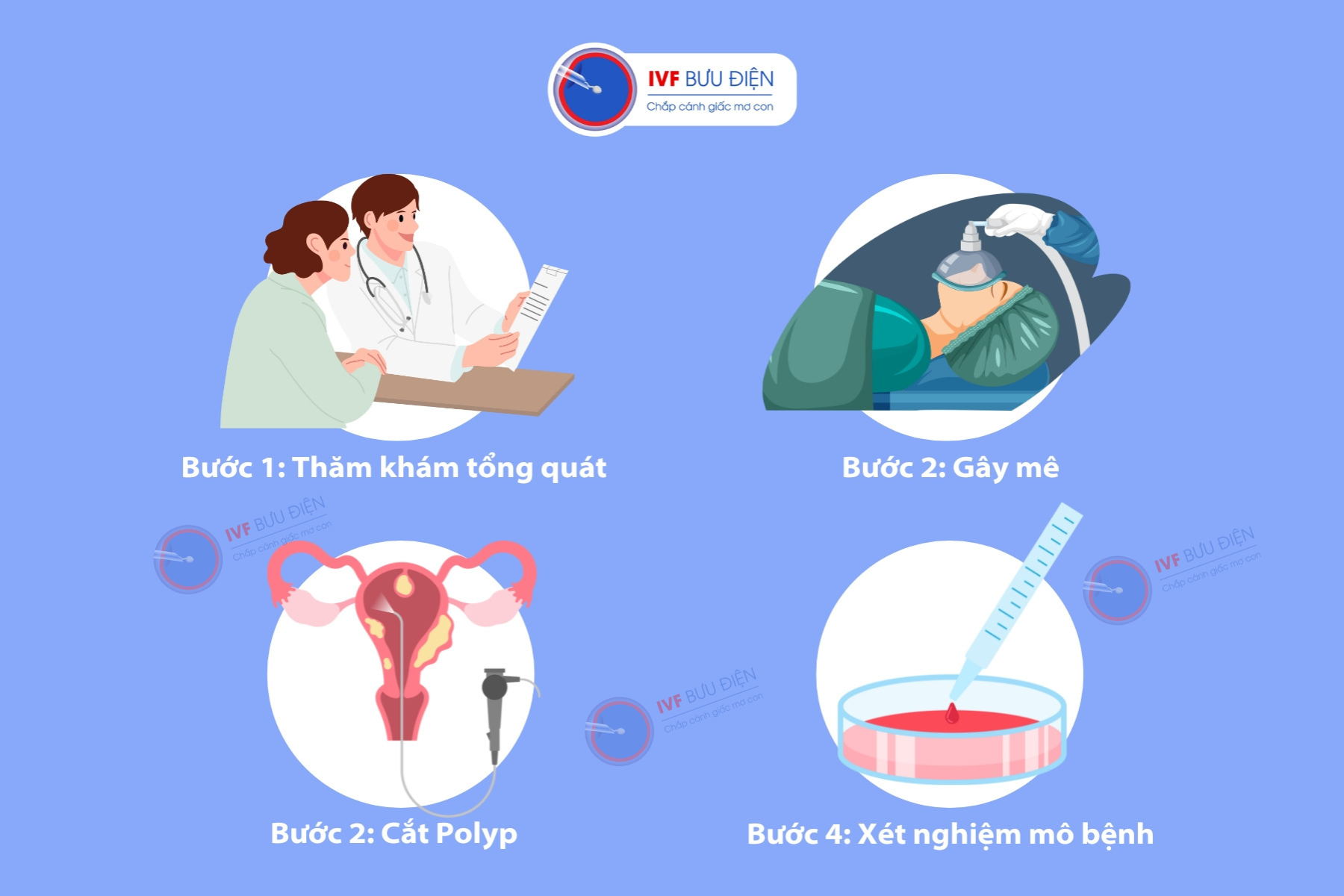 Quy trình mổ polyp tử cung