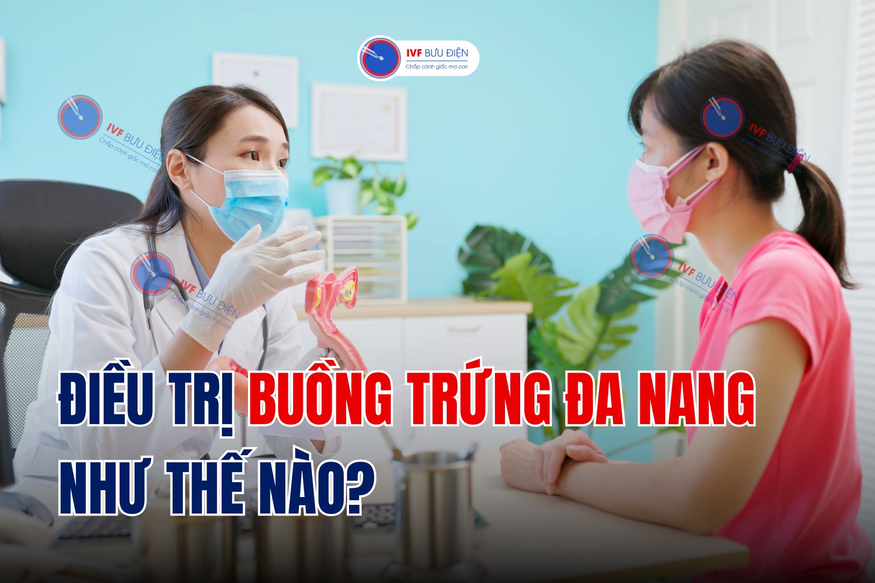 Cách điều trị buồng trứng đa nang như thế nào?