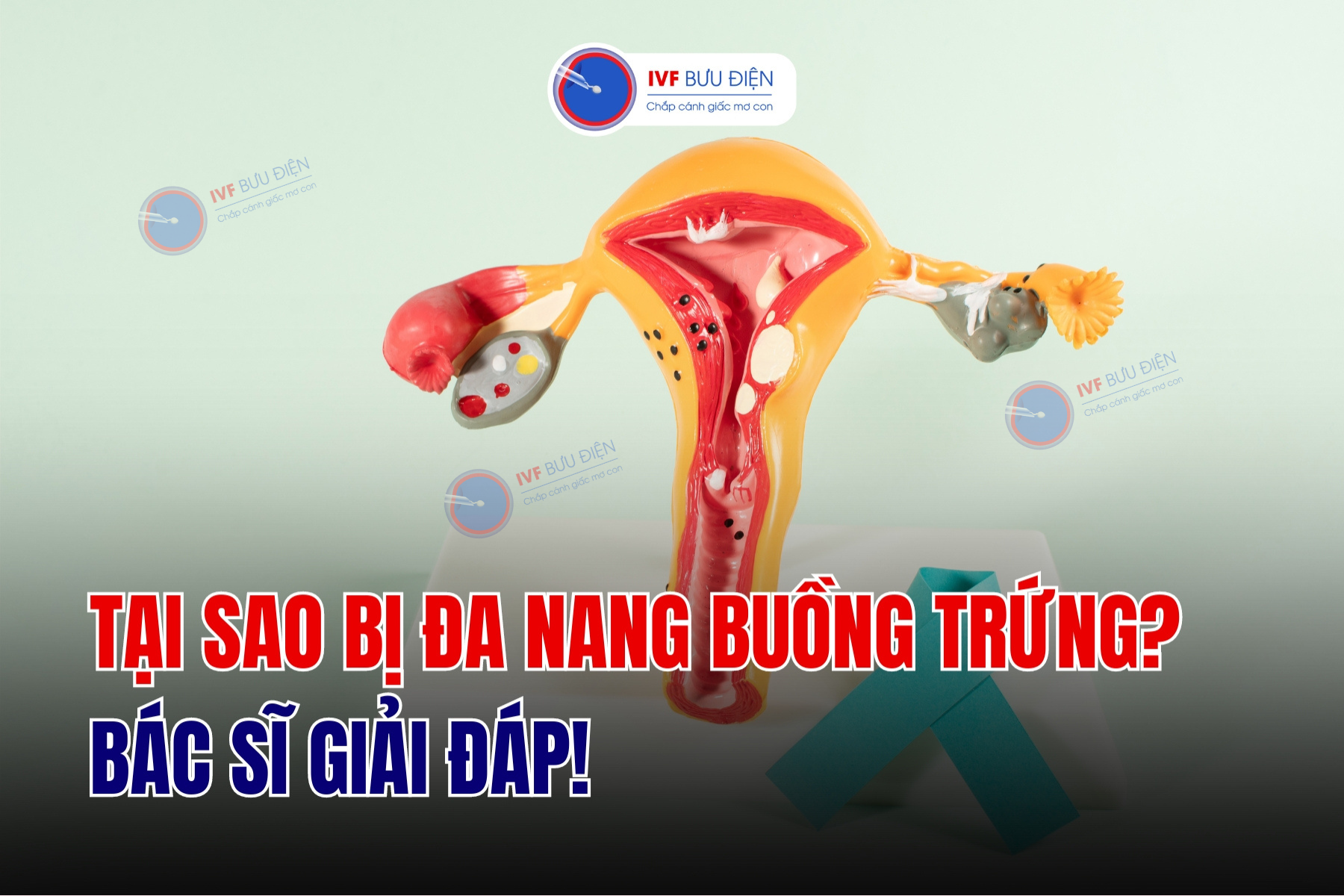 Tại sao bị đa nang buồng trứng? 3 nguyên nhân cần nắm rõ