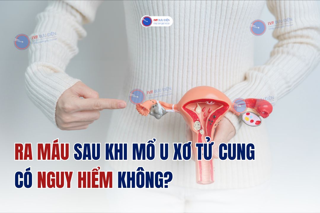 Ra máu sau khi mổ u xơ tử cung có nguy hiểm không?