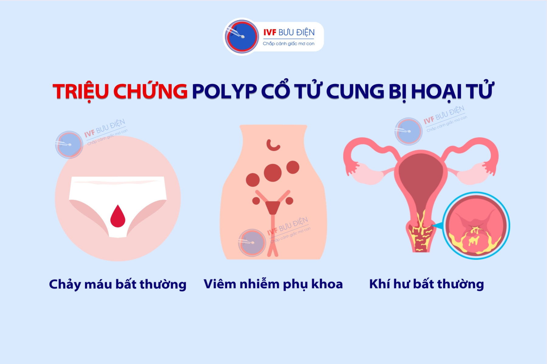 Polyp cổ tử cung bị hoại tử khi mang thai: Nguyên nhân, triệu chứng và điều trị