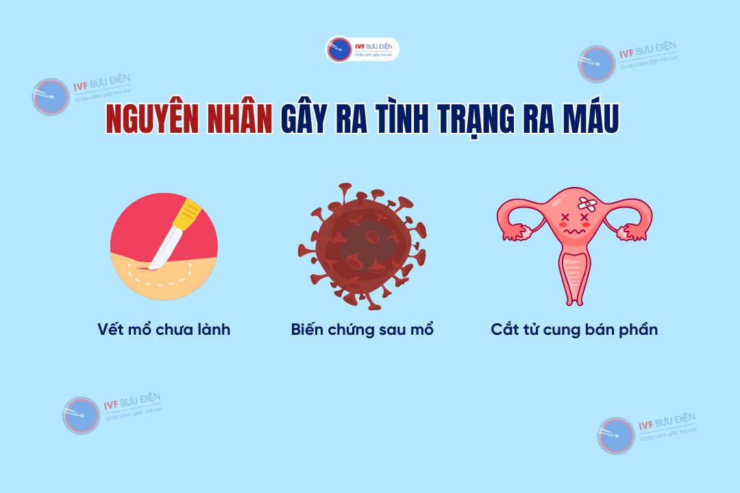 Ra máu sau khi mổ u xơ tử cung: Nguyên nhân gây ra tình trạng này