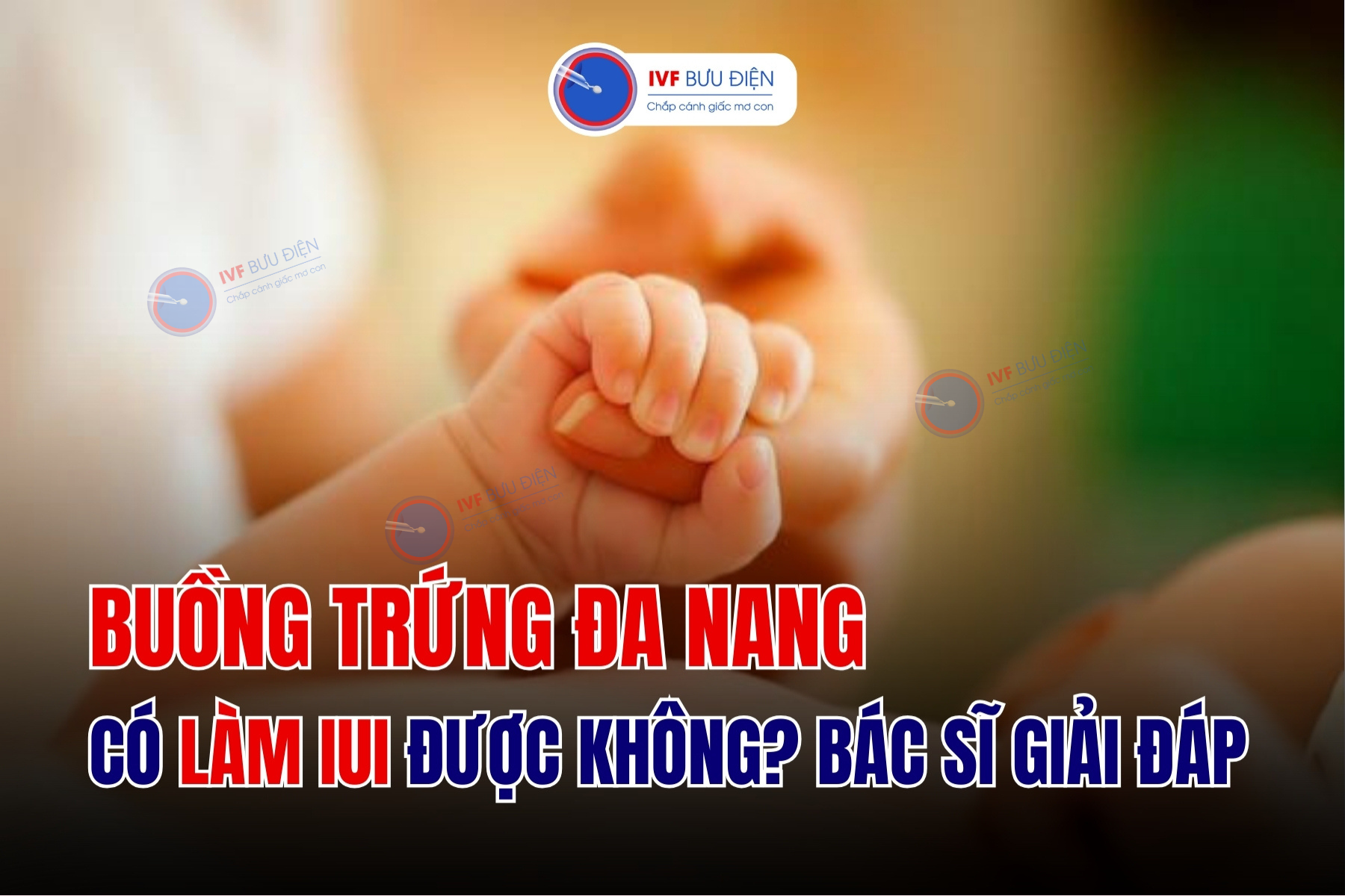 Buồng trứng đa nang có làm IUI được không? Bác sĩ giải đáp