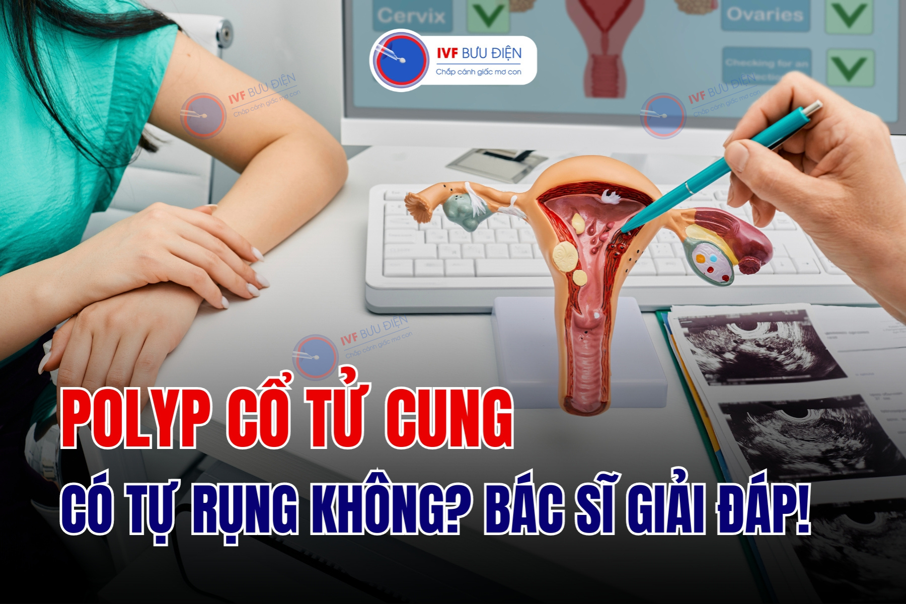 Polyp cổ tử cung có tự rụng không? 4 nguyên nhân gây bệnh