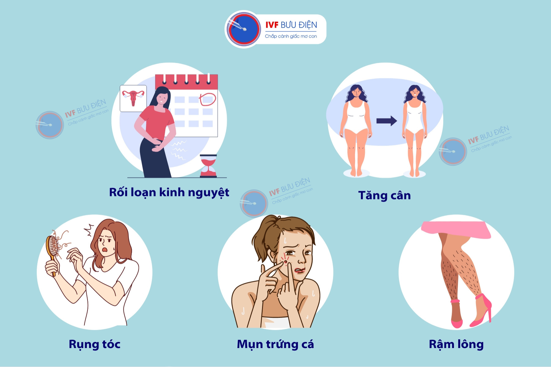 Bệnh buồng trứng đa nang có nguy hiểm không: Triệu chứng của bệnh