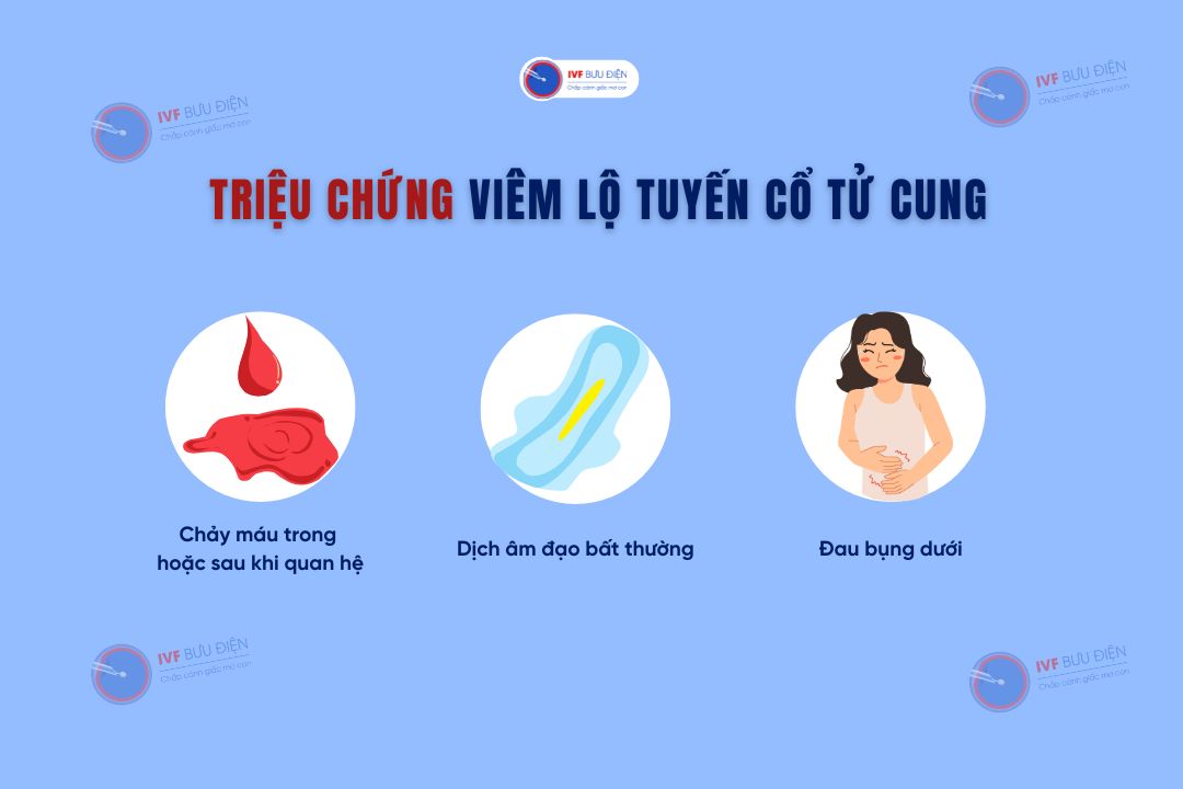 Hình ảnh viêm lộ tuyến cổ tử cung: Những triệu chứng thường gặp