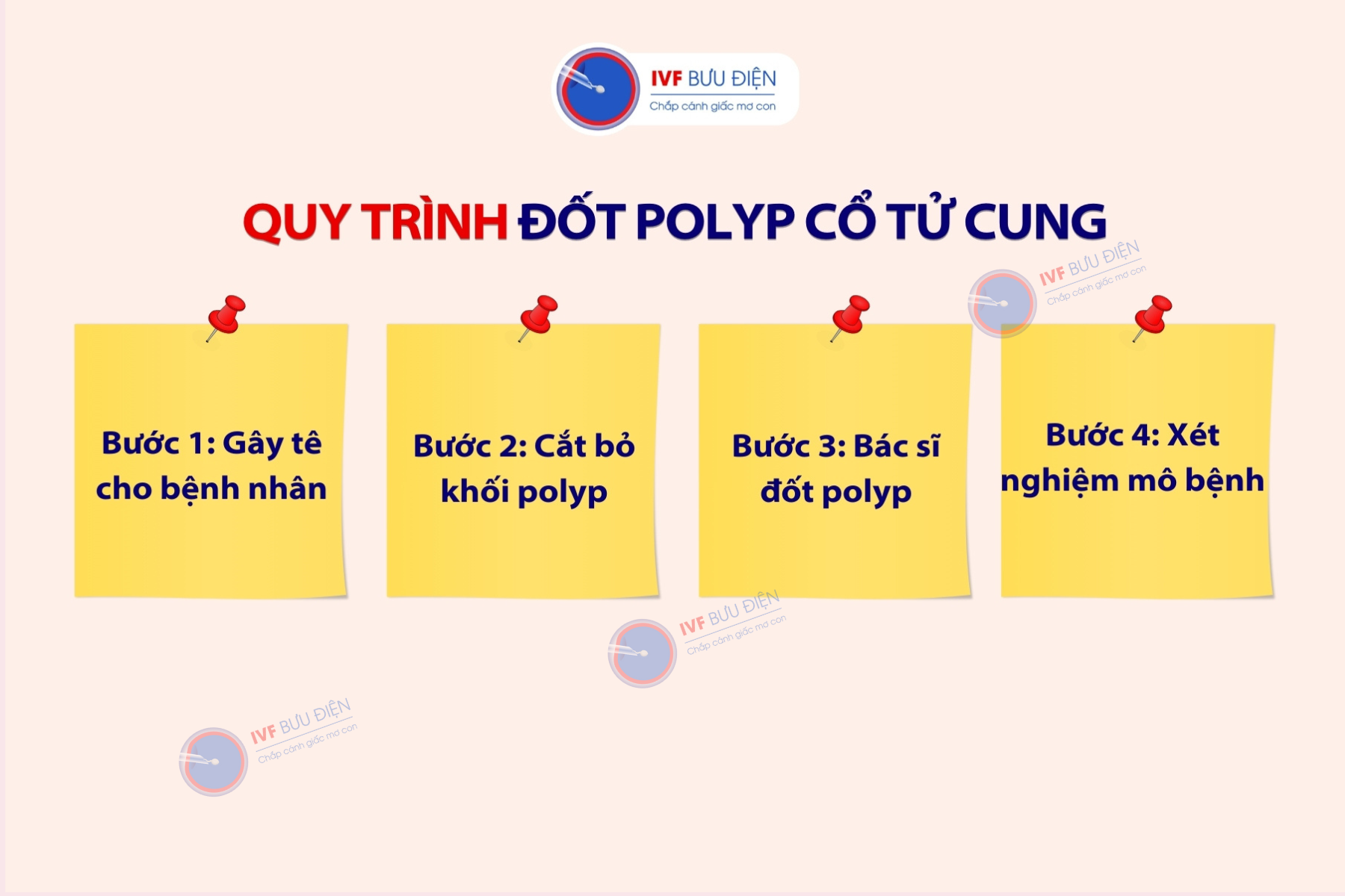 Đốt polyp cổ tử cung: Quy trình thực hiện