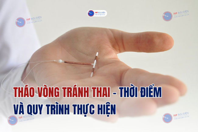 Tháo vòng tránh thai: Thời điểm và quy trình thực hiện