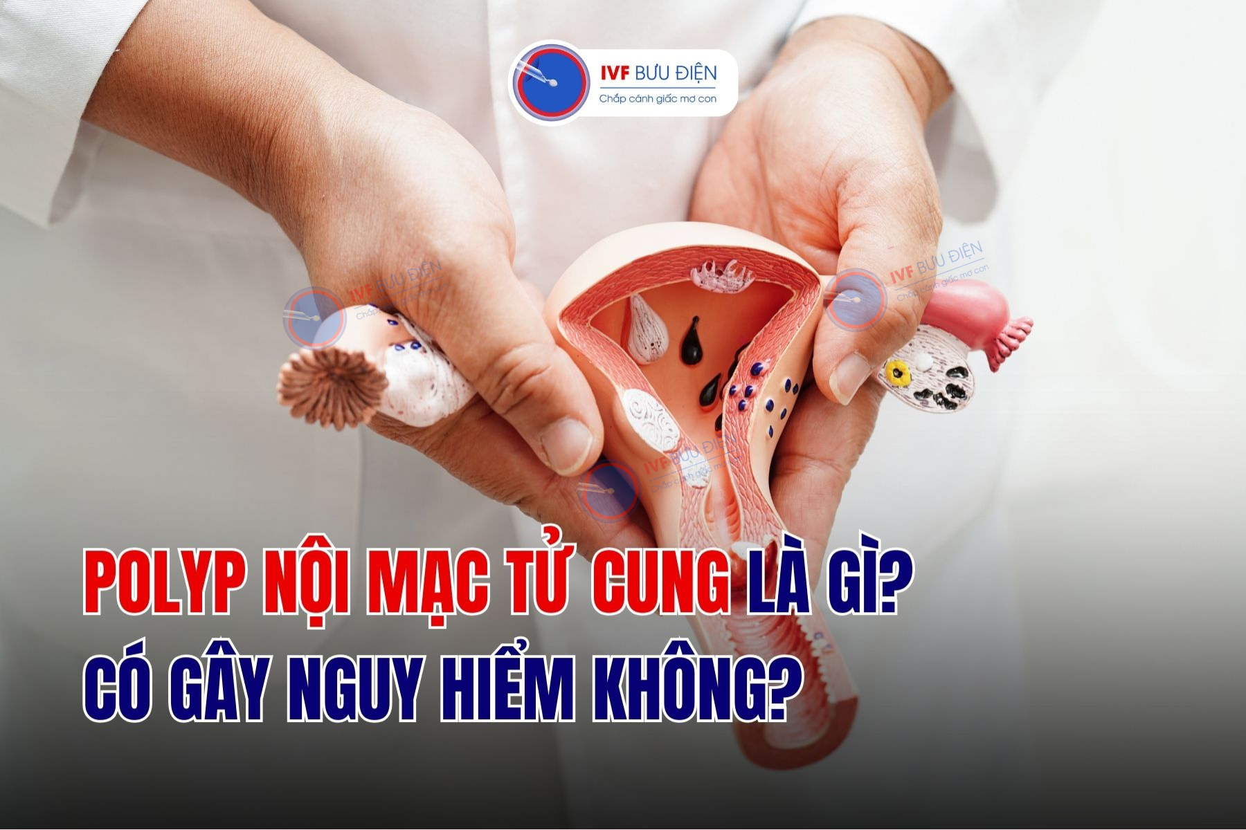 Polyp nội mạc tử cung là gì? Có gây nguy hiểm không?